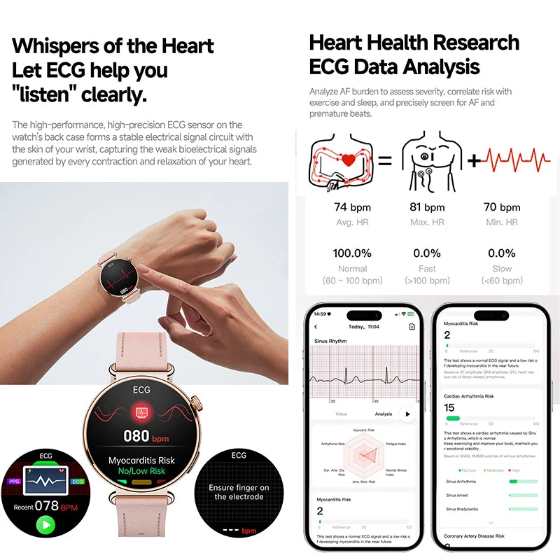 New Women's Smart Watch ECG Health Monitoring Blood Pressure Blood Oxygen Sports SOS Voice Assistant IP68 Waterproof Smart Watch